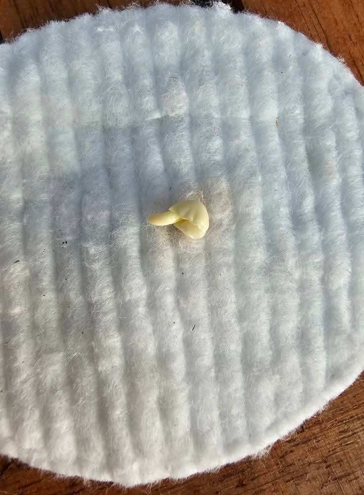 From Seed to Seedling โ How to Germinate Hibiscus Seeds ๐ฑ โ 17